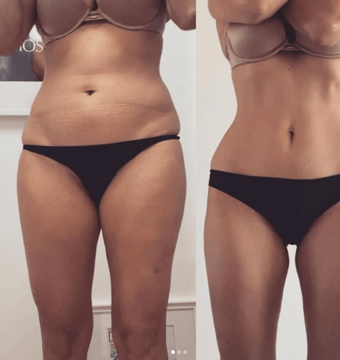 Voornabodyslimming1